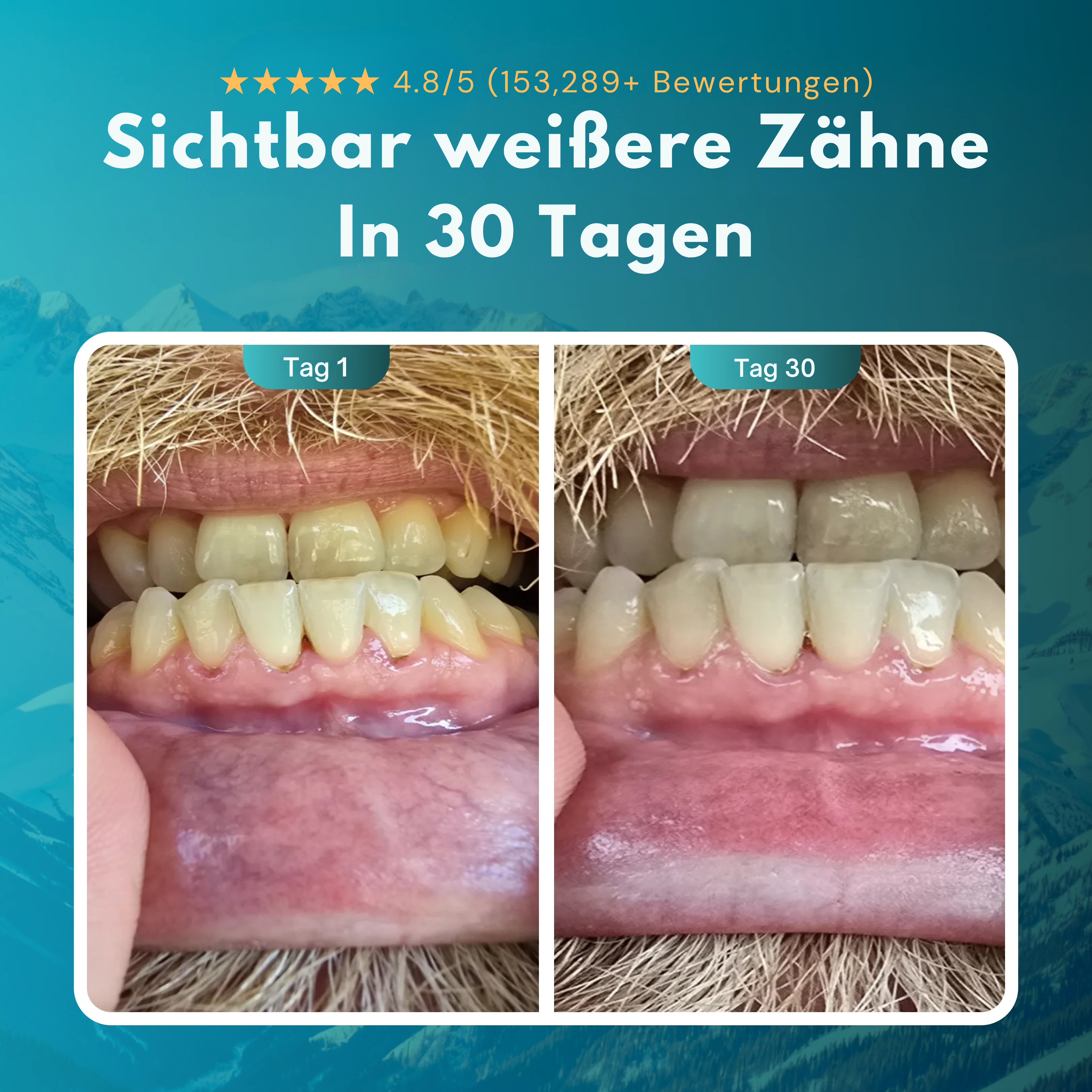 Nutrive™️ – Remineralisierende Zahnfleischpflege